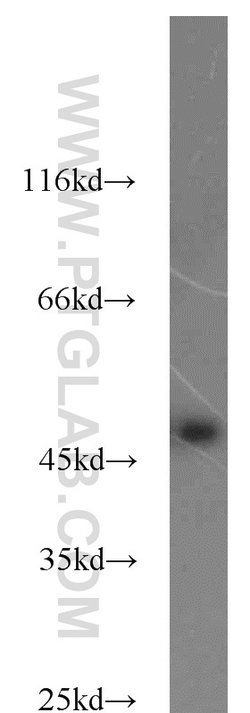 Phospho-RCC1 (Ser12) Rabbit anti-Human, Mouse, Rat, Polyclonal, Proteintech