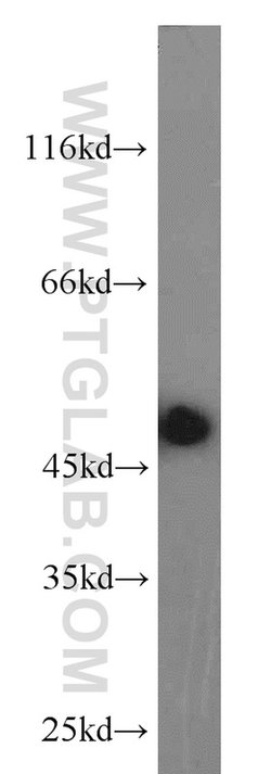 Phospho-RCC1 (Ser12) Rabbit anti-Human, Mouse, Rat, Polyclonal, Proteintech