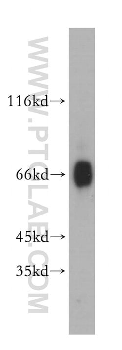 BBS9 Rabbit anti-Human, Mouse, Polyclonal, Proteintech 150 &mu;L; Unconjugated:Antibodies,
