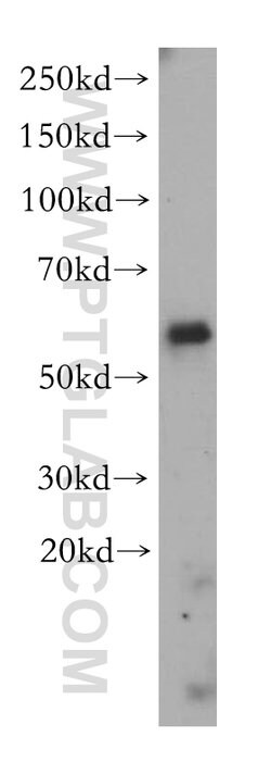 BBS9 Rabbit anti-Human, Mouse, Polyclonal, Proteintech 150 &mu;L; Unconjugated:Antibodies,