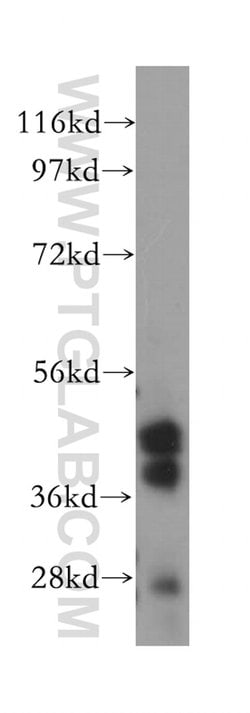 PARVB Rabbit anti-Human, Mouse, Rat, Polyclonal, Proteintech 150 &mu;L;