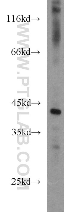 PARVB Rabbit anti-Human, Mouse, Rat, Polyclonal, Proteintech 150 &mu;L;