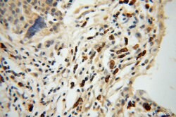 AIG1 Rabbit anti-Human, Mouse, Rat, Polyclonal, Proteintech 20 &mu;L; Unconjugated:Antibodies,