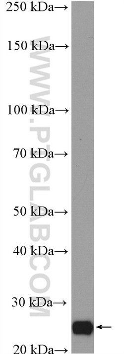 AIG1 Rabbit anti-Human, Mouse, Rat, Polyclonal, Proteintech 20 &mu;L; Unconjugated:Antibodies,
