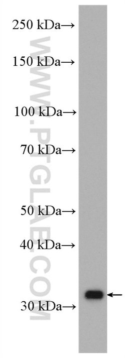 AIG1 Rabbit anti-Human, Mouse, Rat, Polyclonal, Proteintech 20 &mu;L; Unconjugated:Antibodies,