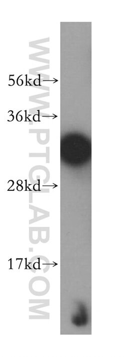 AIG1 Rabbit anti-Human, Mouse, Rat, Polyclonal, Proteintech 20 &mu;L; Unconjugated:Antibodies,