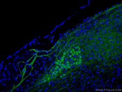 Calbindin-D28k Rabbit anti-Human, Mouse, Rat, Polyclonal, Proteintech:Antibodies:Primary
