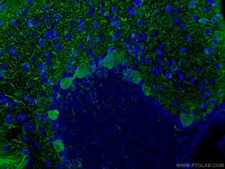 Calbindin-D28k Rabbit anti-Human, Mouse, Rat, Polyclonal, Proteintech:Antibodies:Primary