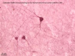 Calbindin-D28k Rabbit anti-Human, Mouse, Rat, Polyclonal, Proteintech:Antibodies:Primary