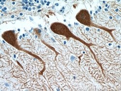 Calbindin-D28k Rabbit anti-Human, Mouse, Rat, Polyclonal, Proteintech:Antibodies:Primary