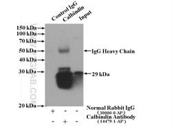 Calbindin-D28k Rabbit anti-Human, Mouse, Rat, Polyclonal, Proteintech:Antibodies:Primary