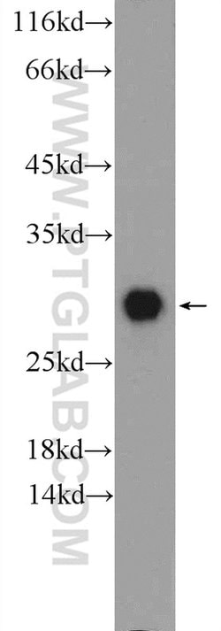 Calbindin-D28k Rabbit anti-Human, Mouse, Rat, Polyclonal, Proteintech:Antibodies:Primary