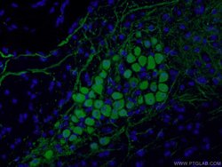 Calbindin-D28k Rabbit anti-Human, Mouse, Rat, Polyclonal, Proteintech:Antibodies:Primary