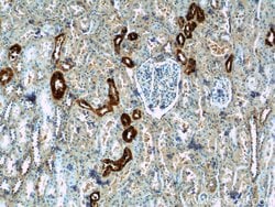 Calbindin-D28k Rabbit anti-Human, Mouse, Rat, Polyclonal, Proteintech:Antibodies:Primary