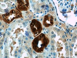 Calbindin-D28k Rabbit anti-Human, Mouse, Rat, Polyclonal, Proteintech:Antibodies:Primary