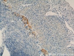 Calbindin-D28k Rabbit anti-Human, Mouse, Rat, Polyclonal, Proteintech:Antibodies:Primary