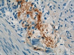 Calbindin-D28k Rabbit anti-Human, Mouse, Rat, Polyclonal, Proteintech:Antibodies:Primary