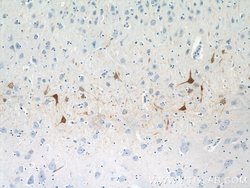 Calbindin-D28k Rabbit anti-Human, Mouse, Rat, Polyclonal, Proteintech:Antibodies:Primary