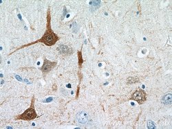 Calbindin-D28k Rabbit anti-Human, Mouse, Rat, Polyclonal, Proteintech:Antibodies:Primary