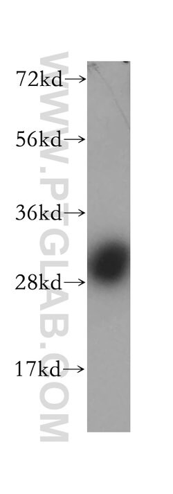 Calbindin-D28k Rabbit anti-Human, Mouse, Rat, Polyclonal, Proteintech:Antibodies:Primary