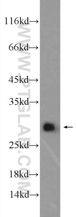 Calbindin-D28k Rabbit anti-Human, Mouse, Rat, Polyclonal, Proteintech:Antibodies:Primary