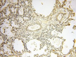 PNPT1 Rabbit anti-Human, Mouse, Rat, Polyclonal, Proteintech 150 &mu;L;