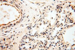 PNPT1 Rabbit anti-Human, Mouse, Rat, Polyclonal, Proteintech 150 &mu;L;