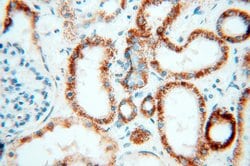 PNPT1 Rabbit anti-Human, Mouse, Rat, Polyclonal, Proteintech 150 &mu;L;
