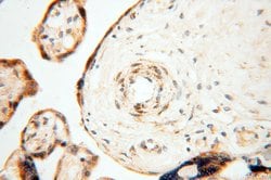 PNPT1 Rabbit anti-Human, Mouse, Rat, Polyclonal, Proteintech 150 &mu;L;
