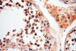 PNPT1 Rabbit anti-Human, Mouse, Rat, Polyclonal, Proteintech 150 &mu;L;