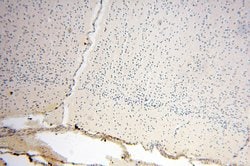 PNPT1 Rabbit anti-Human, Mouse, Rat, Polyclonal, Proteintech 150 &mu;L;