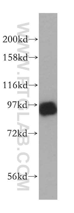 PNPT1 Rabbit anti-Human, Mouse, Rat, Polyclonal, Proteintech 150 &mu;L;