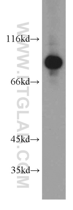 PNPT1 Rabbit anti-Human, Mouse, Rat, Polyclonal, Proteintech 150 &mu;L;