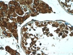 PRM2 Rabbit anti-Human, Mouse, Polyclonal, Proteintech 20 &mu;L | Buy Online | Proteintech | Fisher Scientific