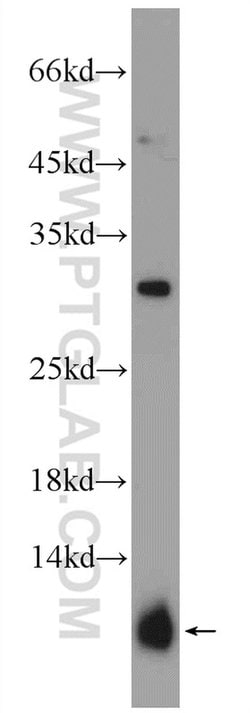 PRM2 Rabbit anti-Human, Mouse, Polyclonal, Proteintech 20 &mu;L | Buy Online | Proteintech | Fisher Scientific