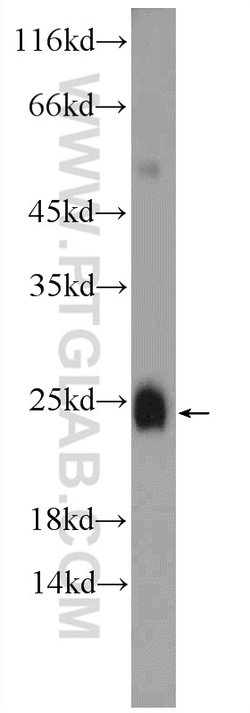 PRM2 Rabbit anti-Human, Mouse, Polyclonal, Proteintech 20 &mu;L | Buy Online | Proteintech | Fisher Scientific