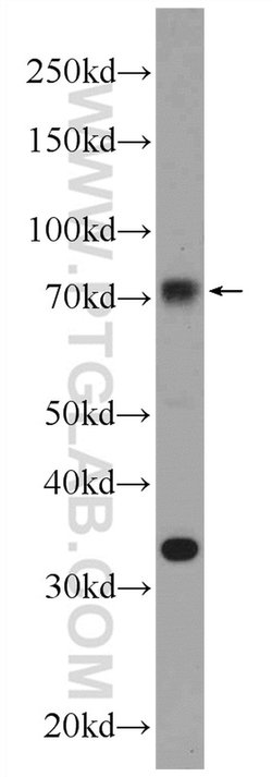 NR1D1 Rabbit anti-Human, Mouse, Polyclonal, Proteintech:Antibodies:Primary