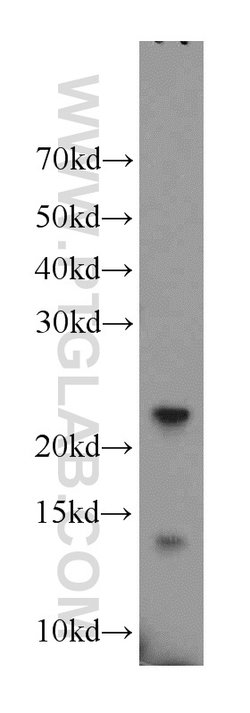 UBL4B Rabbit anti-Human, Mouse, Rat, Polyclonal, Proteintech 150 &mu;L;
