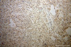 TCF7L1 Rabbit anti-Human, Mouse, Rat, Polyclonal, Proteintech:Anticuerpos:Anticuerpos
