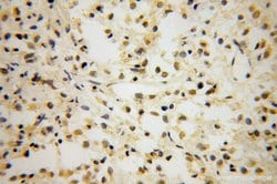 TCF7L1 Rabbit anti-Human, Mouse, Rat, Polyclonal, Proteintech:Anticuerpos:Anticuerpos