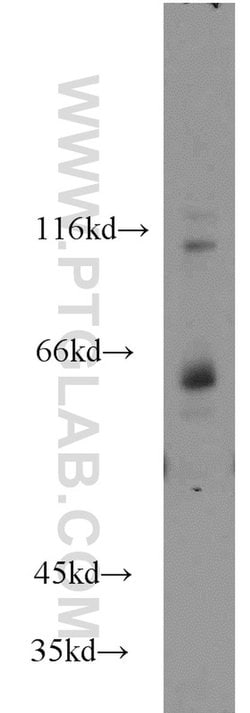 TCF7L1 Rabbit anti-Human, Mouse, Rat, Polyclonal, Proteintech:Anticuerpos:Anticuerpos