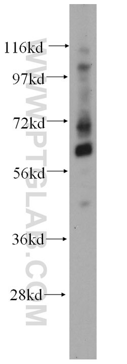 TCF7L1 Rabbit anti-Human, Mouse, Rat, Polyclonal, Proteintech:Anticuerpos:Anticuerpos
