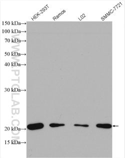 UBC12 Rabbit anti-Human, Mouse, Rat, Polyclonal, Proteintech:Antibodies:Primary