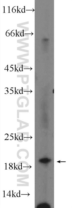 UBC12 Rabbit anti-Human, Mouse, Rat, Polyclonal, Proteintech:Antibodies:Primary