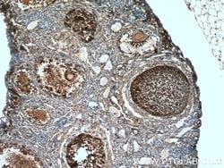 UBC12 Rabbit anti-Human, Mouse, Rat, Polyclonal, Proteintech:Antibodies:Primary