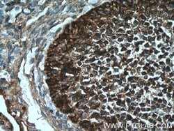 UBC12 Rabbit anti-Human, Mouse, Rat, Polyclonal, Proteintech:Antibodies:Primary