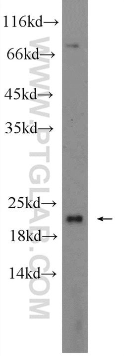 UBC12 Rabbit anti-Human, Mouse, Rat, Polyclonal, Proteintech:Antibodies:Primary