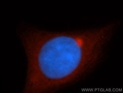 CRMP2 Rabbit anti-Human, Mouse, Rat, Polyclonal, Proteintech 20 &mu;L;