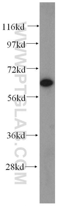 CRMP2 Rabbit anti-Human, Mouse, Rat, Polyclonal, Proteintech 20 &mu;L;