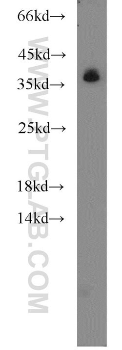 hnRNP-E1 Rabbit anti-Human, Mouse, Rat, Polyclonal, Proteintech 150 &mu;L;